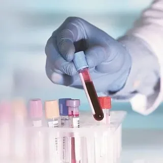 Lab Testeing Lab Test At Home In Dubai | Safe And Professional Service